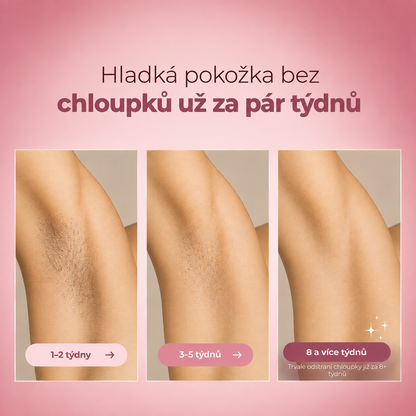 Teny IPL Laserový odstraňovač chloupků